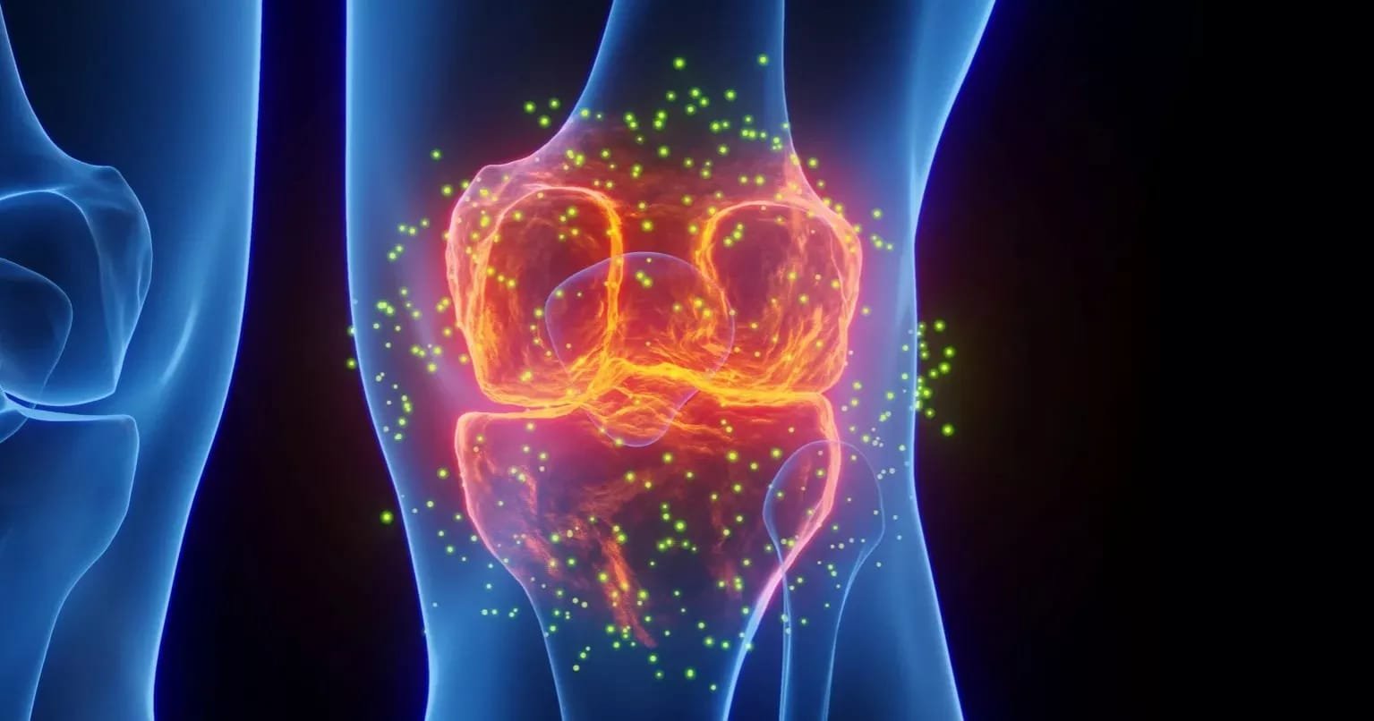Ultra-processed foods may raise knee osteoarthritis risk