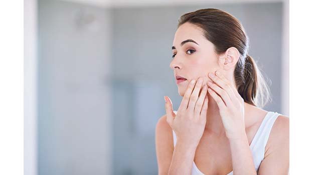 Habits that are probably giving you acne!