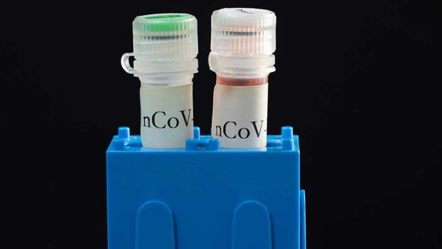 Pvt hospitals allowed to test coronavirus