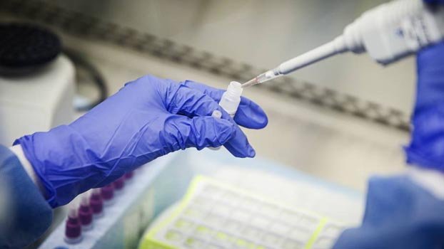 Lack of technologists for corona  testing