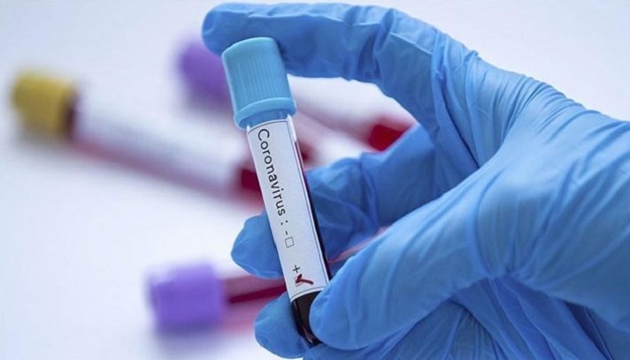 49 new Covid-19 cases in Chandpur