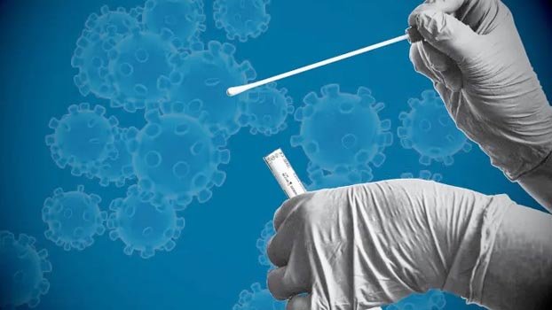  Number of labs up, tests down