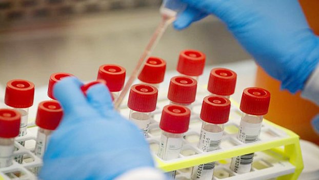 SUST research finds new genomes of Covid-19