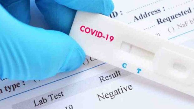 Covid antigen test starts in Dhaka from Saturday