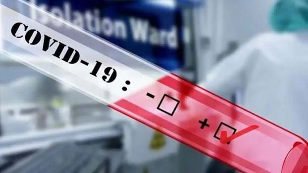 8 die, 616 tested positive for covid  in Ctg