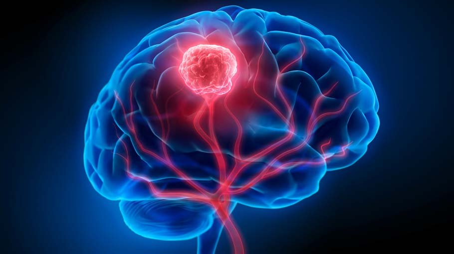 Treatment for neuroblastoma (part 5)