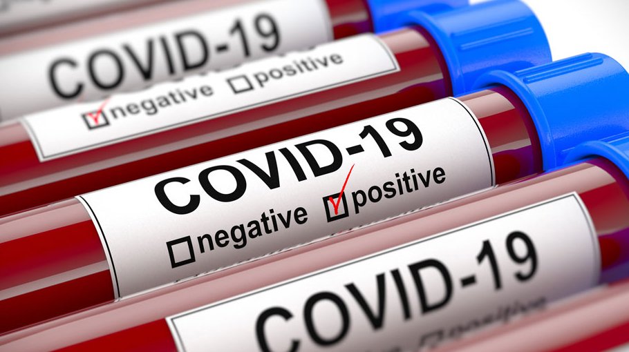 Six test positive for Covid-19 in Ctg