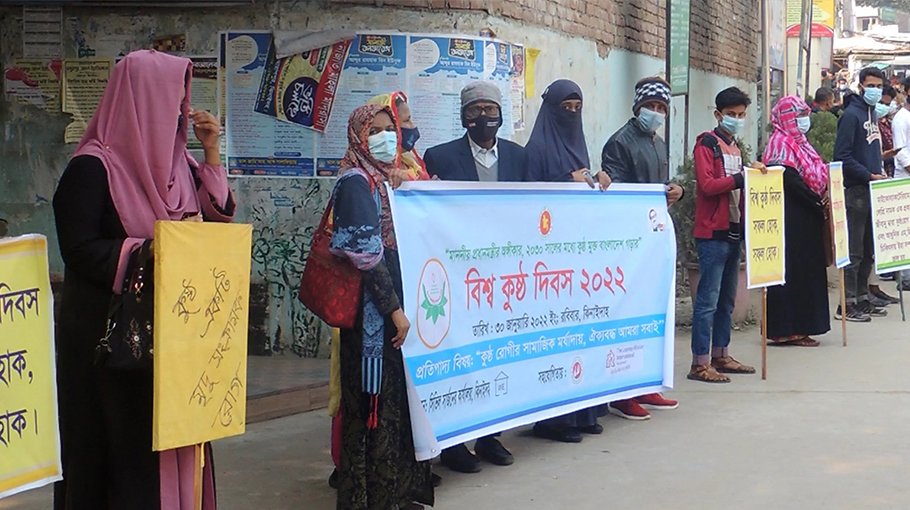 Jhenaidah health office observe World Leprosy Day