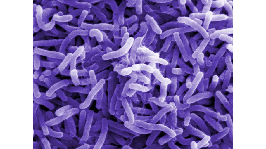 Cholera, its symptoms (part 1)