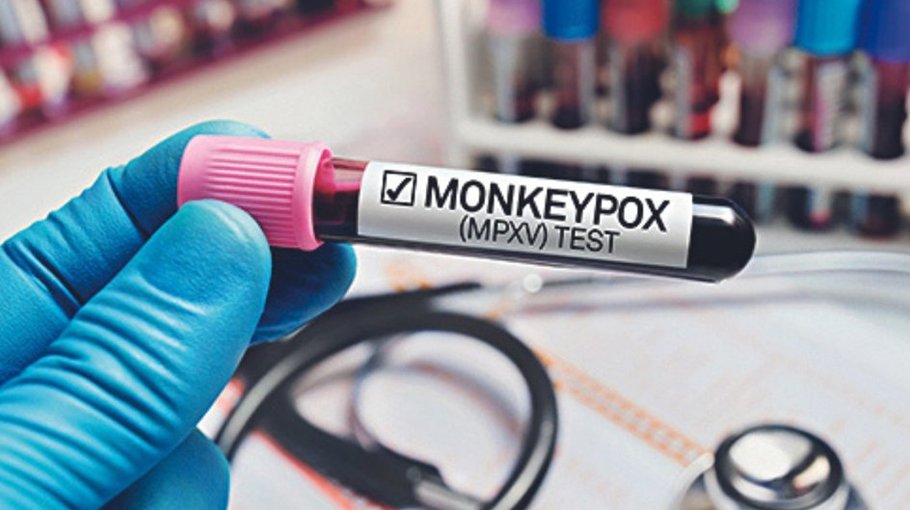 India orders health screening at ports, airports to minimise risk of monkeypox