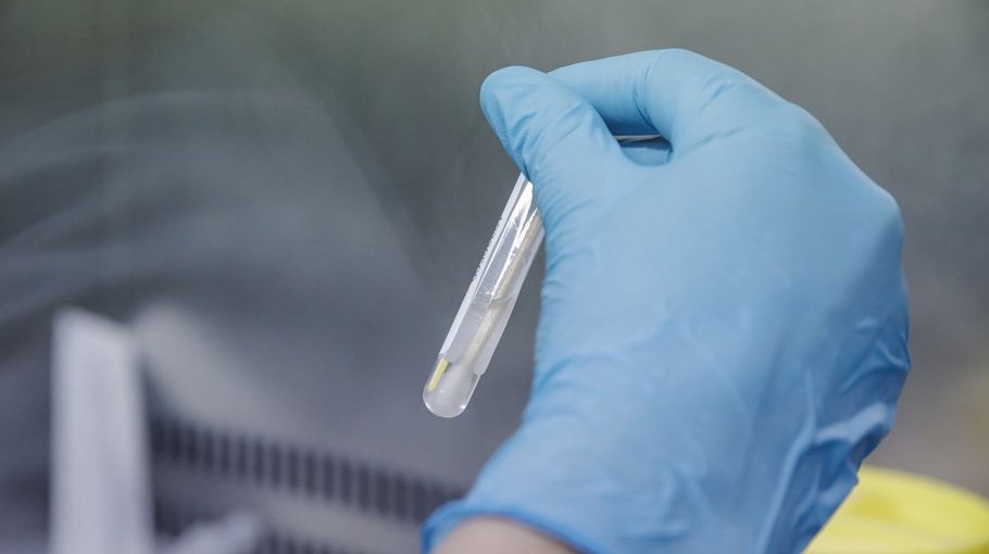 New Monkeypox tests are needed to contain the disease