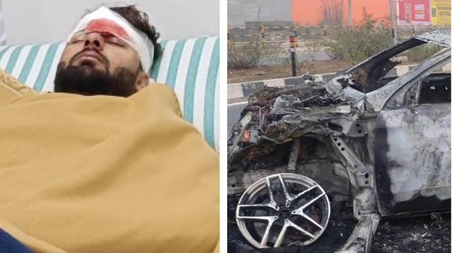 India wicketkeeper Pant hospitalised after car crash