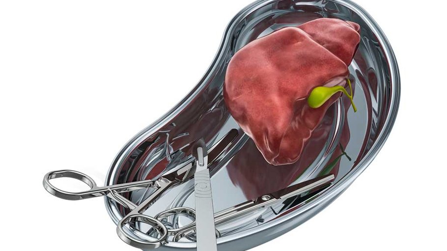 Liver transplant at low cost locally