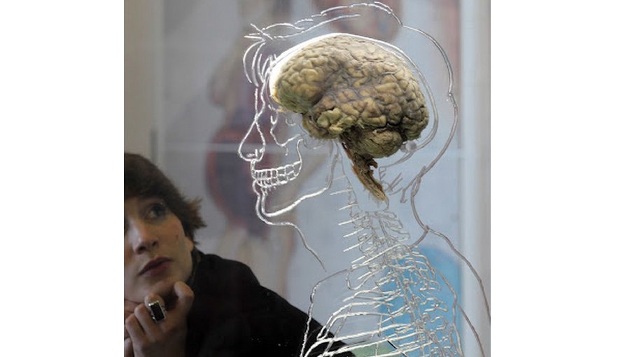 Evidence is mounting that Covid is bad for the brain