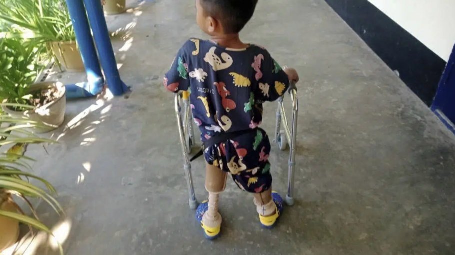 Myanmar landmine casualties soar