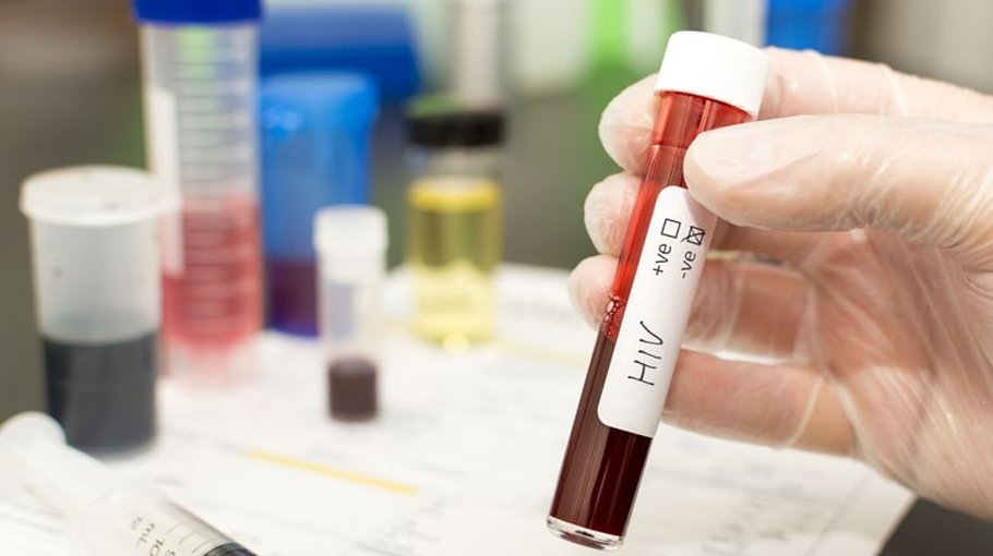 Third person cured of HIV 