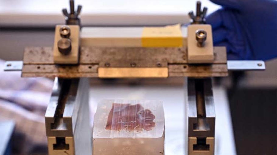 Chilling past of world’s biggest brain collection