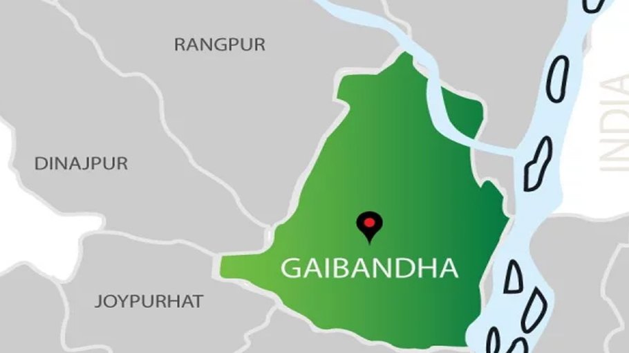 Station master loses hands, leg in train accident