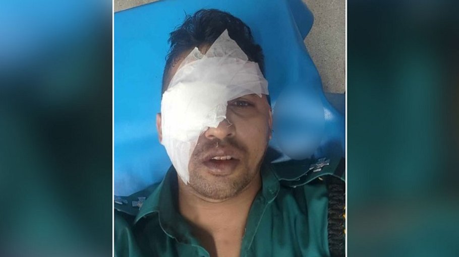Cop loses eye in hijra attack