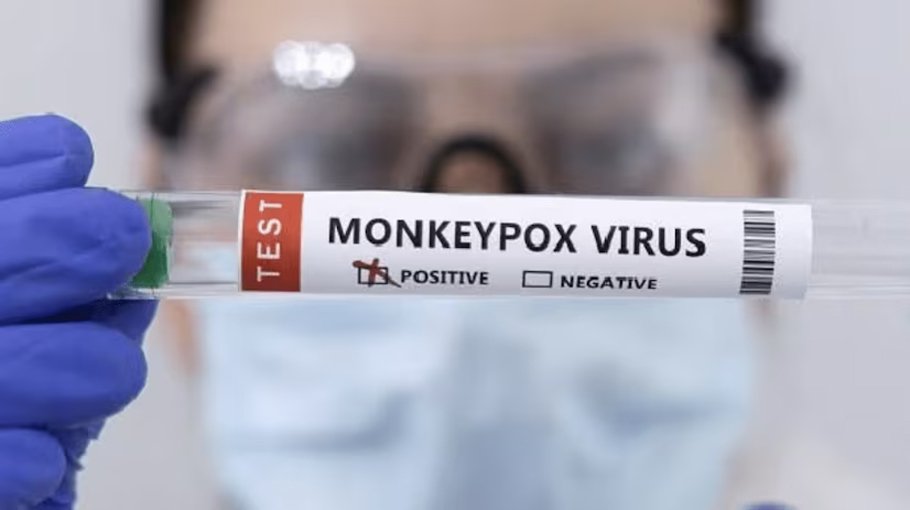Govt issues  mpox alert