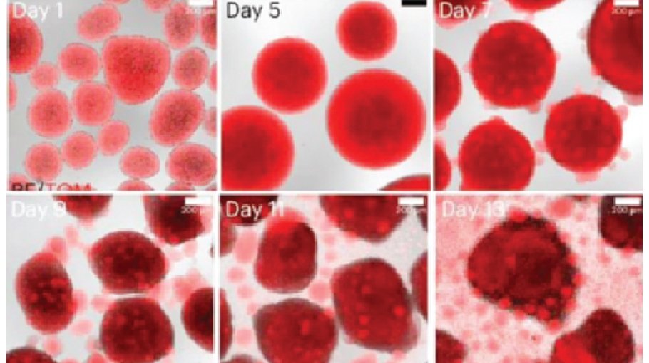 Lab-grown blood stem cells for the first time