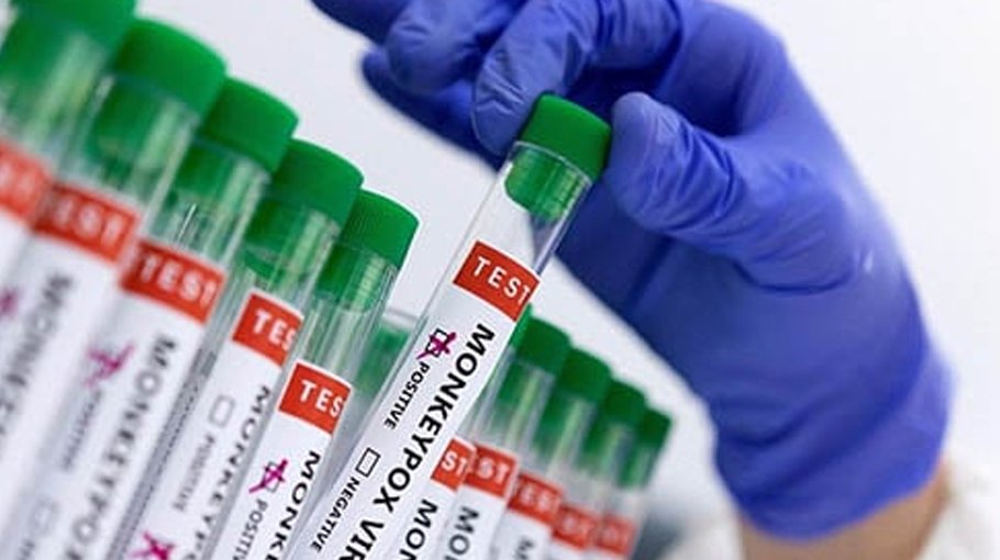 World better positioned against mpox than   for Covid