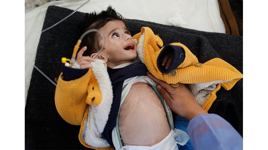 How modern conflict weaponises food