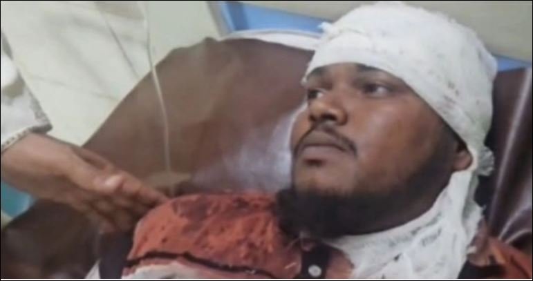 Nine injured in BNP-Jamaat clash in Jashore