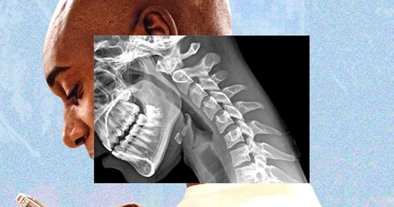 Heavy screen use may be taking a toll on your body