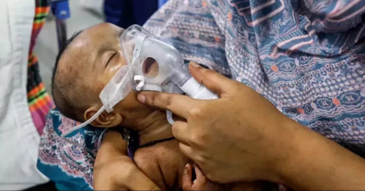 3 more children die of measles-like symptoms in Sylhet