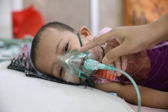 Measles: 5 more die; death toll stands at 1053