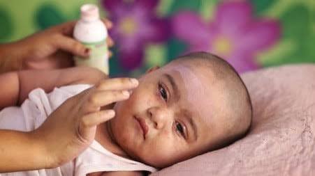 Measles-Like symptoms claim seven more lives in Bangladesh